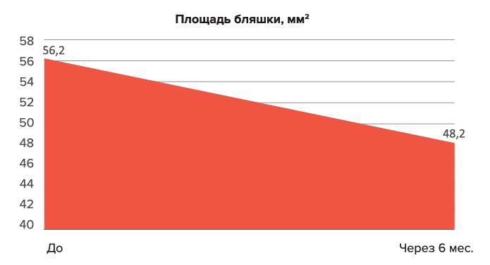 Кейс: Неоперативное лечение болезни Пейрони у пациентов в возрасте от 46 до 63 лет