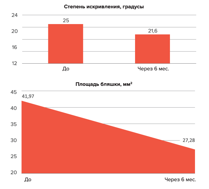 Кейс: Низкоинтенсивная экстракорпоральная ударно-волновая терапия в лечении болезни Пейрони